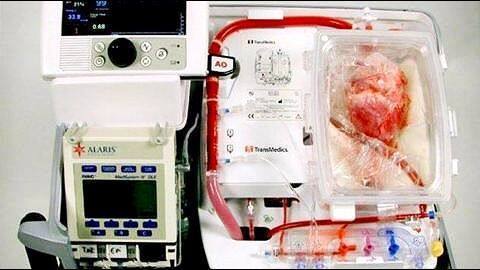 New method keeps hearts "alive" for 12 hours outside body New method keeps hearts "alive" for 12 hours outside body