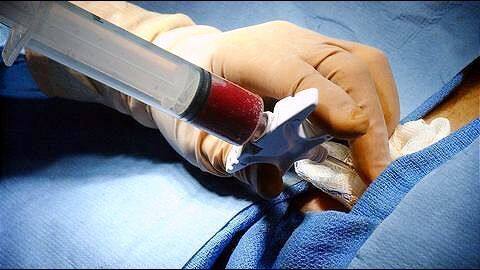 Bengaluru: Free, subsidized treatment saves lives of 50 Thalassemic children Bengaluru: Free, subsidized treatment saves lives of 50 Thalassemic children