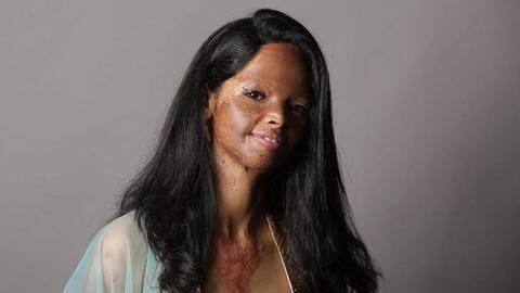 Acid attack survivor and social activist, Laxmi Agarwal Acid attack survivor and social activist, Laxmi Agarwal