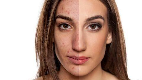 Want to get an even skin tone? Follow these tips Want to get an even skin tone? Follow these tips