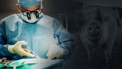 In a first, US doctors transplant pig heart into man In a first, US doctors transplant pig heart into man