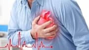 Heart attacks may be caused by infections, finds study
