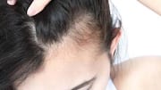 5 ways to style your hairline wisps 