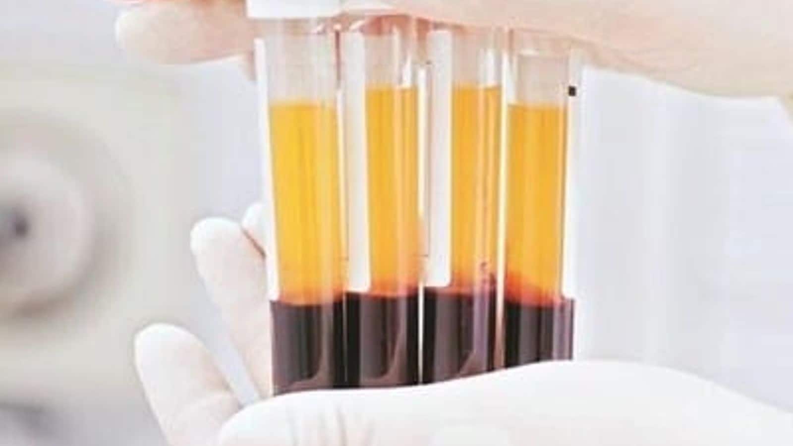 Final report on UK's infected blood scandal will release tomorrow