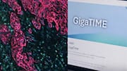 'GigaTIME': Microsoft's new AI could speed up cancer tissue analysis