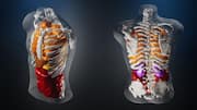 Midjourney moves beyond AI images, unveils full-body ultrasound scanner