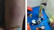 Infant dropped, bitten, beaten: CCTV captures Noida daycare worker's assault 