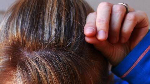 Struggling with gray hair? Here's how Ayurveda can help Struggling with gray hair? Here's how Ayurveda can help