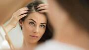 Say goodbye to dry scalp with these effective home remedies