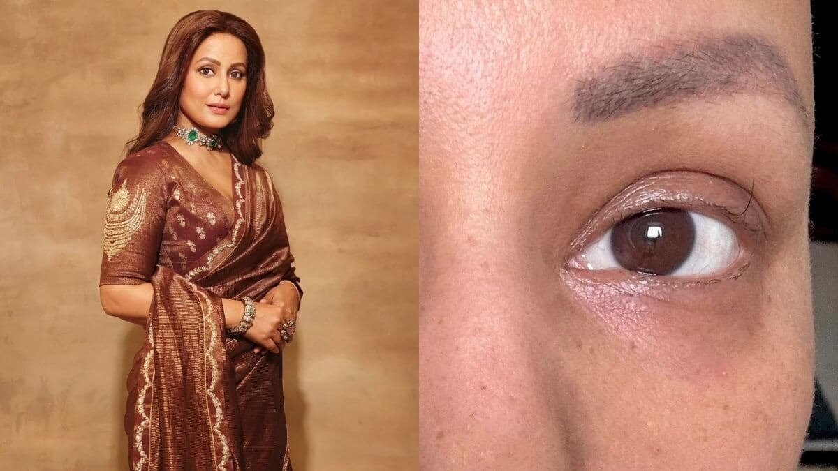 Hina shares her 'last standing eyelash' photo amid final chemotherapy