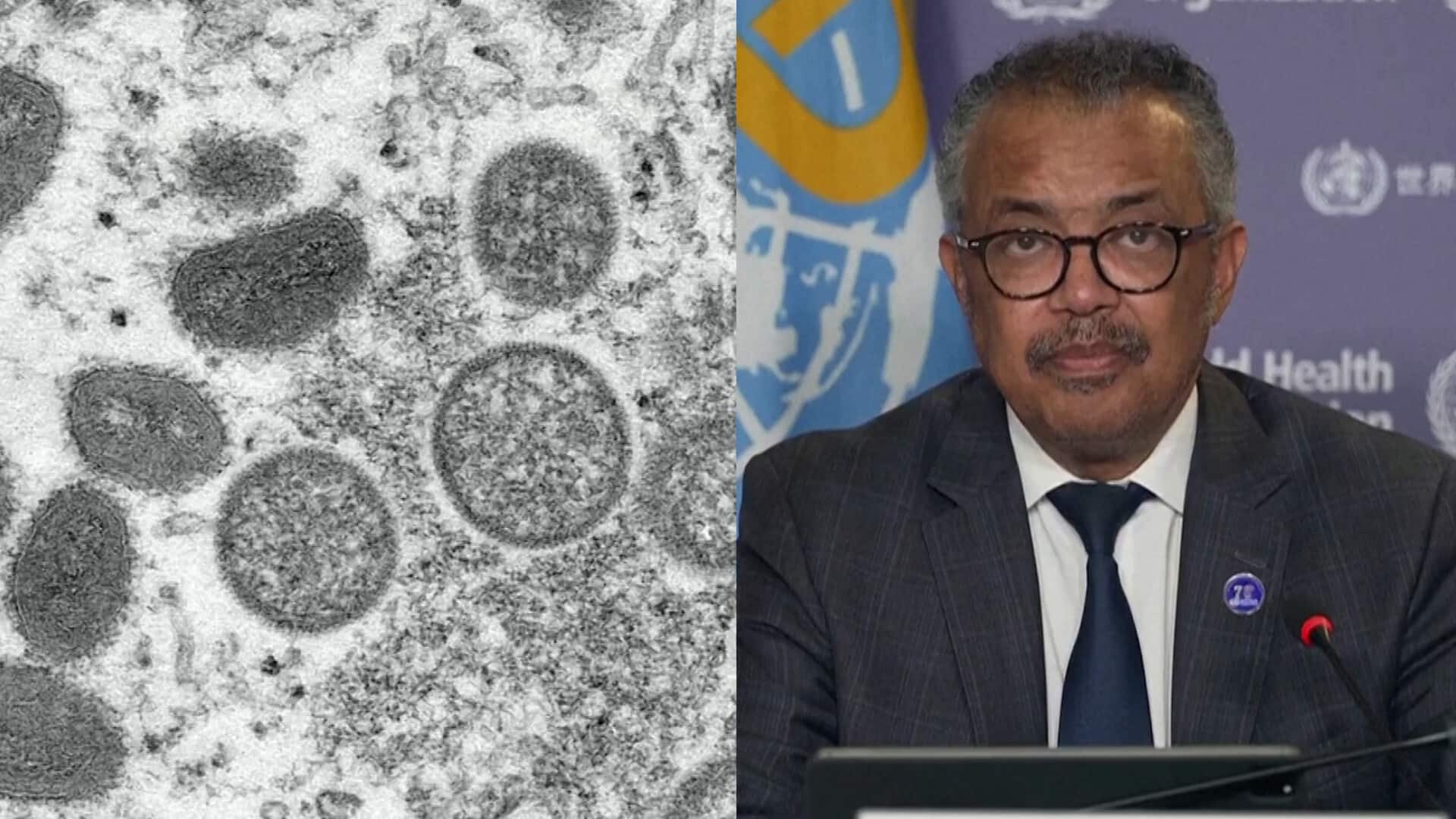 Explained: WHO declares mpox as global public health emergency