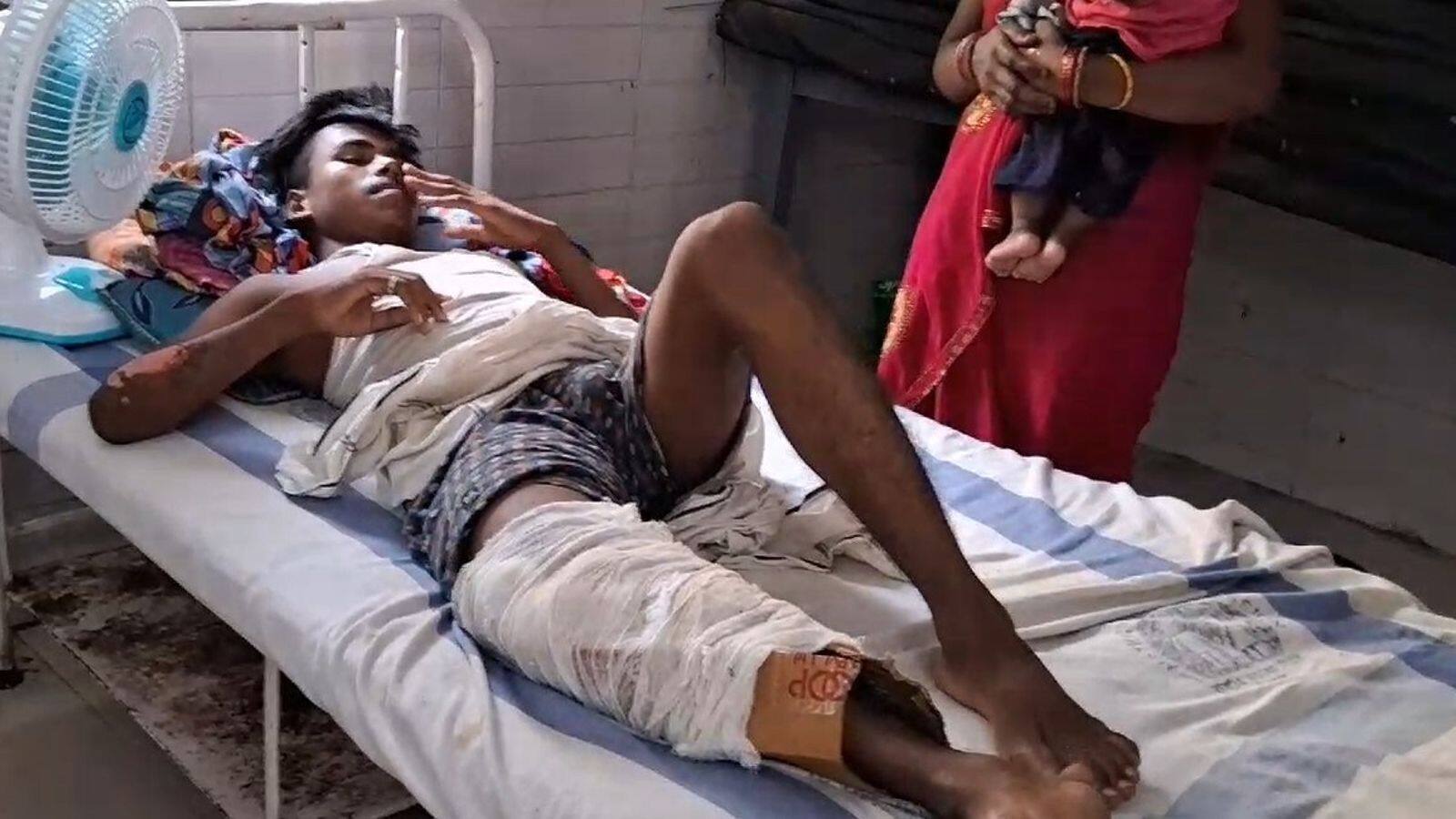 Bihar: Man's leg plastered with cardboard at health center