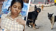 17 stitches on face: Stray dogs maul Kanpur college student