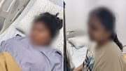 2 Bengaluru students attacked by stray dogs; 1 in ICU 