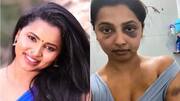 Tamil actor Anicka accuses ex-boyfriend of assault, shares disturbing pictures