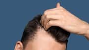 How to achieve a flawless hairline 