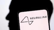 Neuralink's brain chip can restore hearing, claims Elon Musk