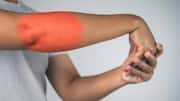 Stiff elbows? These exercises can help