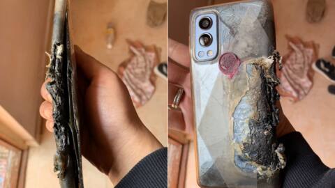 OnePlus Nord 2 blasts again; user suffers major burns OnePlus Nord 2 blasts again; user suffers major burns