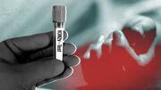 H3N2: Health ministry says cases to decline by March-end