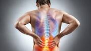 Osteoporosis: Causes, symptoms, prevention, and treatment