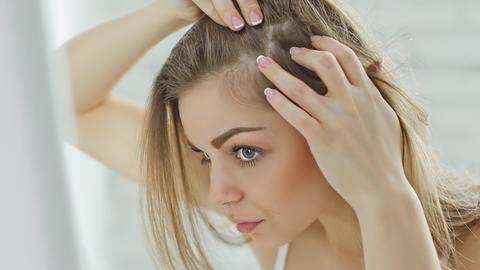 What is scalp acne? Its causes, types, and prevention What is scalp acne? Its causes, types, and prevention