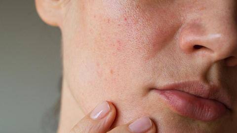 Some effective ways to minimize the appearance of skin pores Some effective ways to minimize the appearance of skin pores