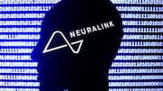 Neuralink is ready for first human brain implant restoring vision 