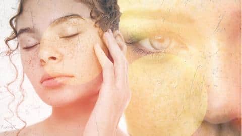 How to prevent and treat hyperpigmentation How to prevent and treat hyperpigmentation
