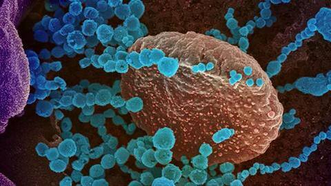 Mutations help Epsilon coronavirus variant evade vaccine immunity, says study Mutations help Epsilon coronavirus variant evade vaccine immunity, says study