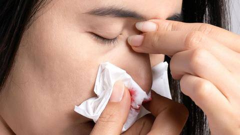 #HealthBytes: Nose bleeding after COVID-19 recovery; causes, prevention, and first-aid #HealthBytes: Nose bleeding after COVID-19 recovery; causes, prevention, and first-aid