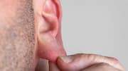 How to treat earlobe irritation at home