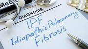 Idiopathic pulmonary fibrosis: Symptoms, causes, and treatment