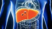 60% liver cancer cases preventable via lifestyle changes and vaccination