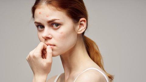 Simple home remedies that can help fade age-old scars Simple home remedies that can help fade age-old scars