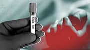 Karnataka reports first H3N2 death a week after lab report