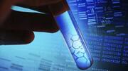 Reliance's genome test kit to launch soon, costs Rs. 12,000