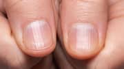 Fix fingernail ridges with these kitchen ingredients