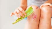 Aloe vera gel can heal minor skin cuts