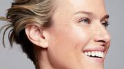 Crow's feet: All you need to know about this condition