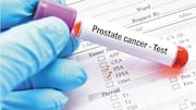 Do all men have to undergo a prostate cancer test?