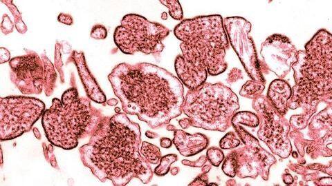 Nipah virus outbreak: All you need to know about it Nipah virus outbreak: All you need to know about it