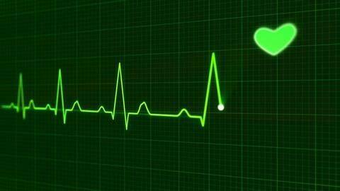 Details about the Apple Watch Series 4's ECG feature Details about the Apple Watch Series 4's ECG feature