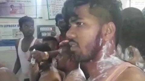 Karnataka: Mystery acid attack on Congress rally injures 10 Karnataka: Mystery acid attack on Congress rally injures 10