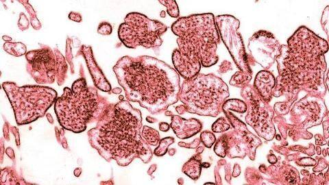 Nipah Virus: All about symptoms, prevention, and treatment Nipah Virus: All about symptoms, prevention, and treatment
