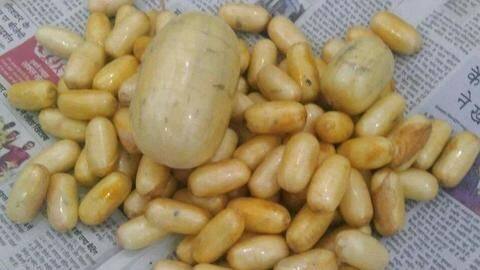 Narcotics bureau extracts 106 cocaine capsules from Brazilian woman's stomach Narcotics bureau extracts 106 cocaine capsules from Brazilian woman's stomach
