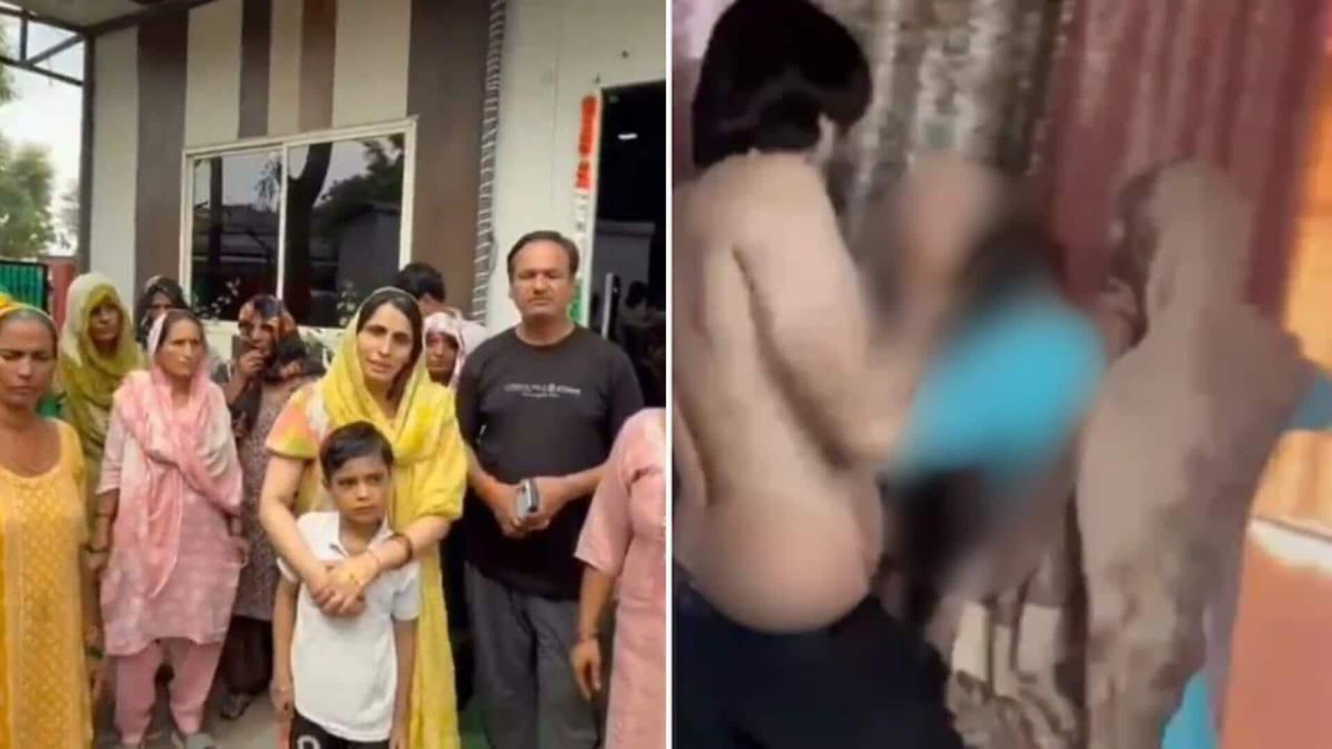 Noida dowry death accused shot in leg while fleeing custody Noida dowry death accused shot in leg while fleeing custody