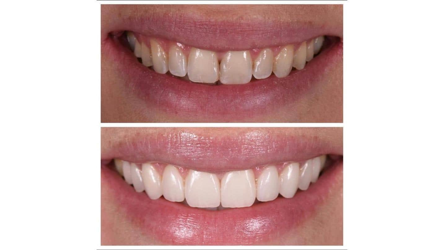 US: Top 8 cosmetic dentists, surgeons to achieve perfect smile ...