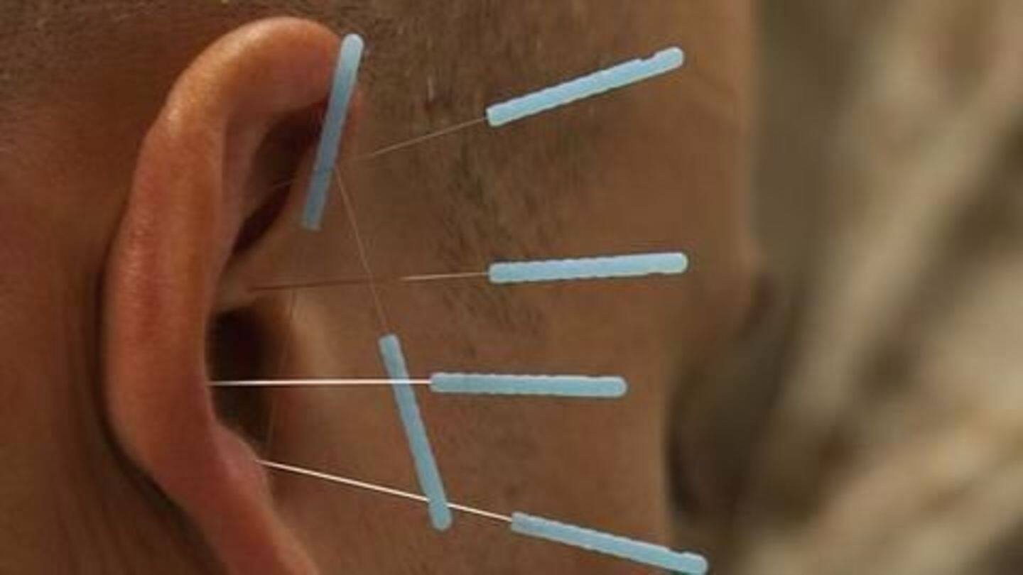 150 pins found in man's body, doctors suspect mental illness