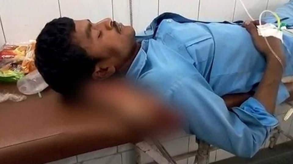 Bizarre: Jhansi hospital uses patient's severed leg as pillow